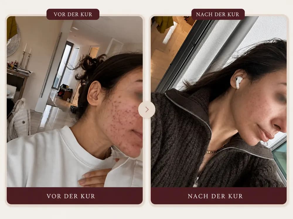 Vorher und nach der Kur — Tuna Askar