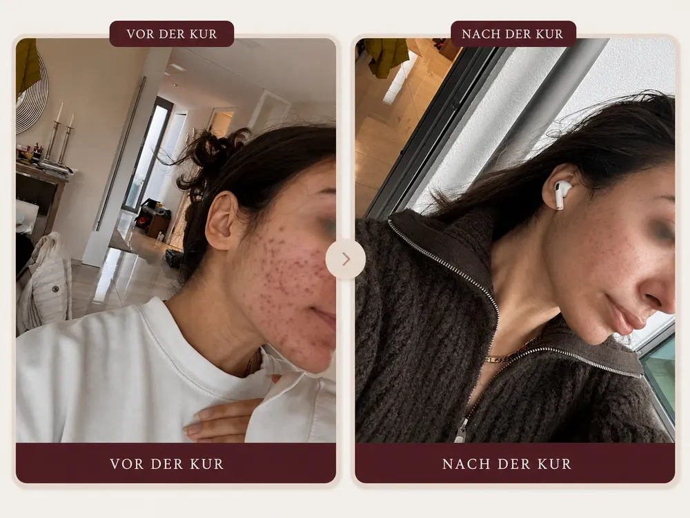 Veränderung, die eine Frau bei sich bemerkt hat — vorher und nachher
